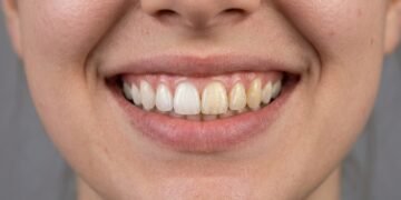 Esses são os melhores alimentos que irão ajudar a clarear seus dentes de forma natural