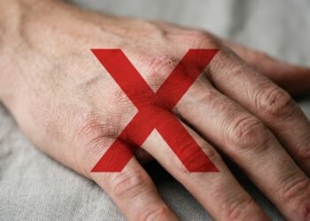 Adeus mãos ásperas e doloridas: a mudança simples no banho e na pia que reduz rachaduras no inverno
