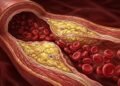 Colesterol "bom" e "ruim": diferenças, riscos reais e marcadores que preocupam os cardiologistas
