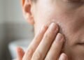 O erro no skincare que promete renovar a pele, mas pode destruir a barreira de proteção do rosto