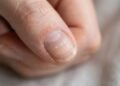 O que suas unhas estão tentando avisar quando mudam de cor, quebram fácil ou aparecem com marcas estranhas