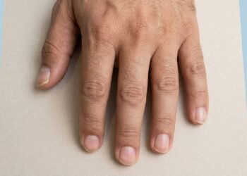Cor, formato e textura ajudam a separar mudanças comuns de alertas importantes