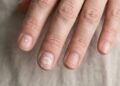 Unhas brancas nem sempre são normais e estes sinais mostram quando é preciso se preocupar