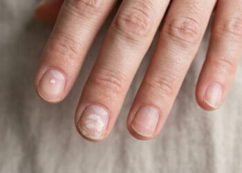 O tamanho, a textura e a evolução da mudança ajudam a medir a preocupação.